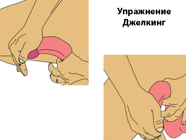 Схематический рисунок